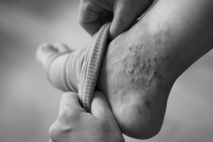 Steunkousen aantrekken