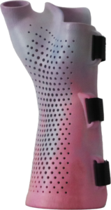 Pastelorthese vrijstaand